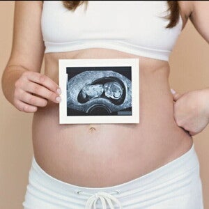 Pregnant woman relaxed, representing the broader benefits of probiotics in supporting male and female fertility beyond digestive health